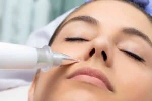 Best Actinic Keratoses Removal 3 Actinic keratoses Clacton-on-Sea solutions - book in today!